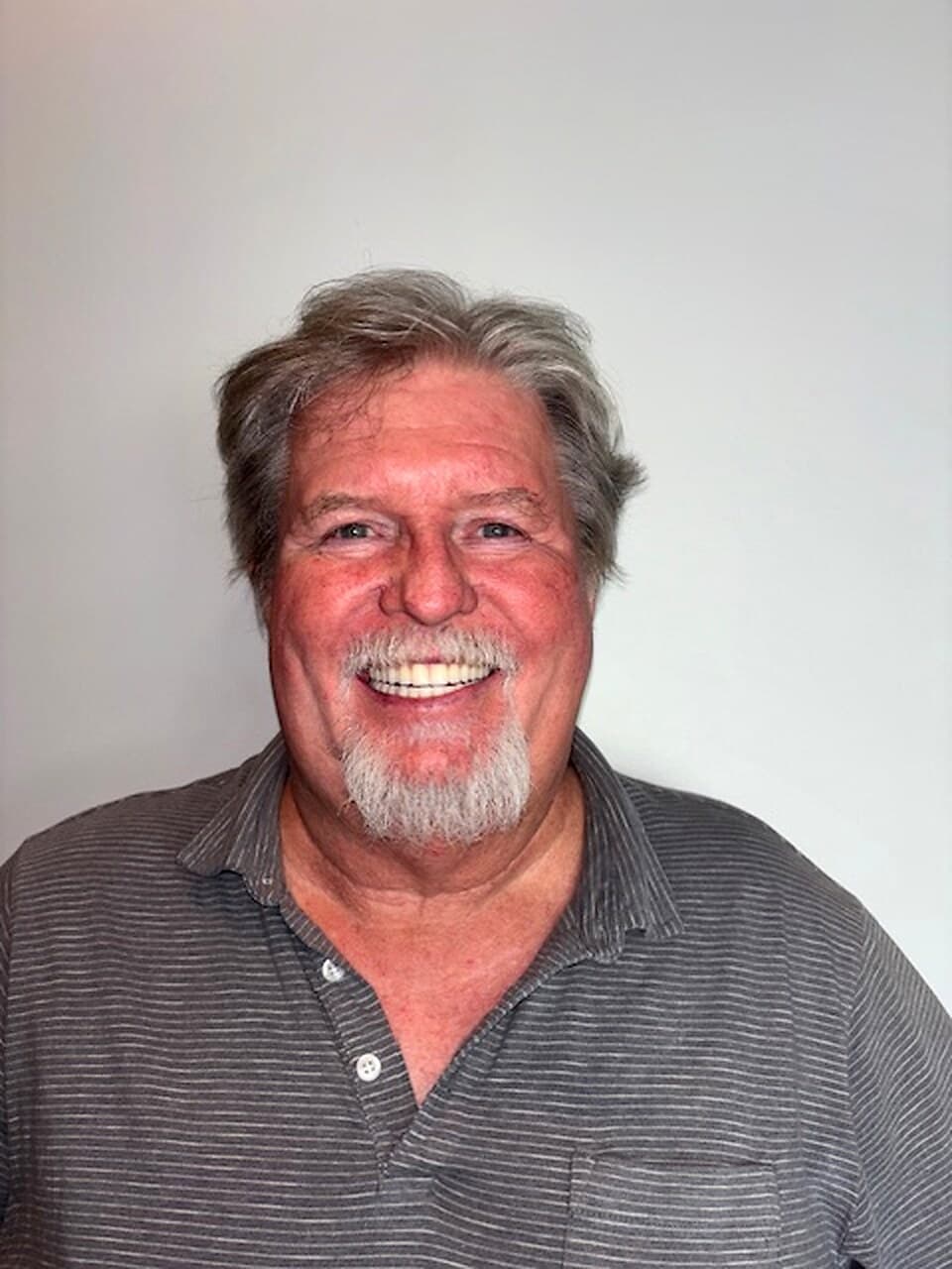 Before and after, Kevin S., All-on-4